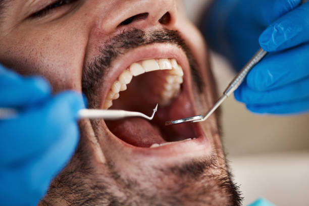 Best Weekend Emergency Dentist in Humansville, MO