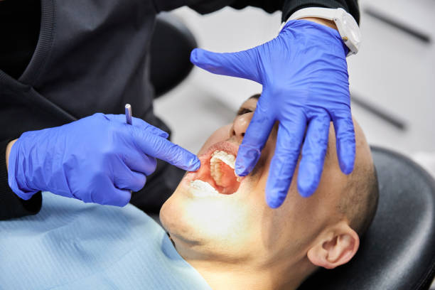Best Emergency Tooth Extraction in Humansville, MO