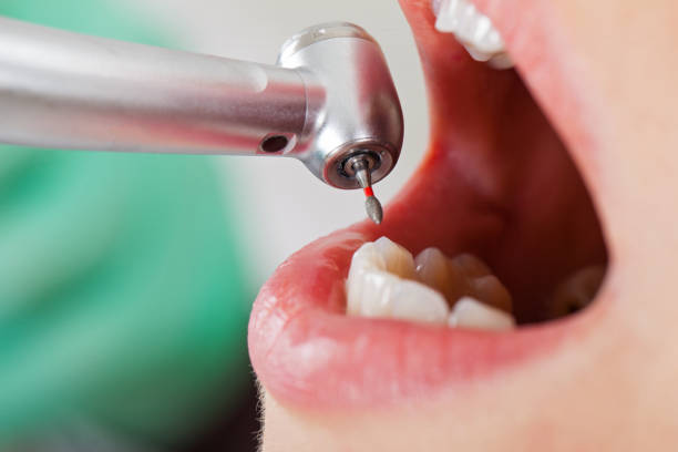 Best Emergency Treatment for Toothache in Humansville, MO
